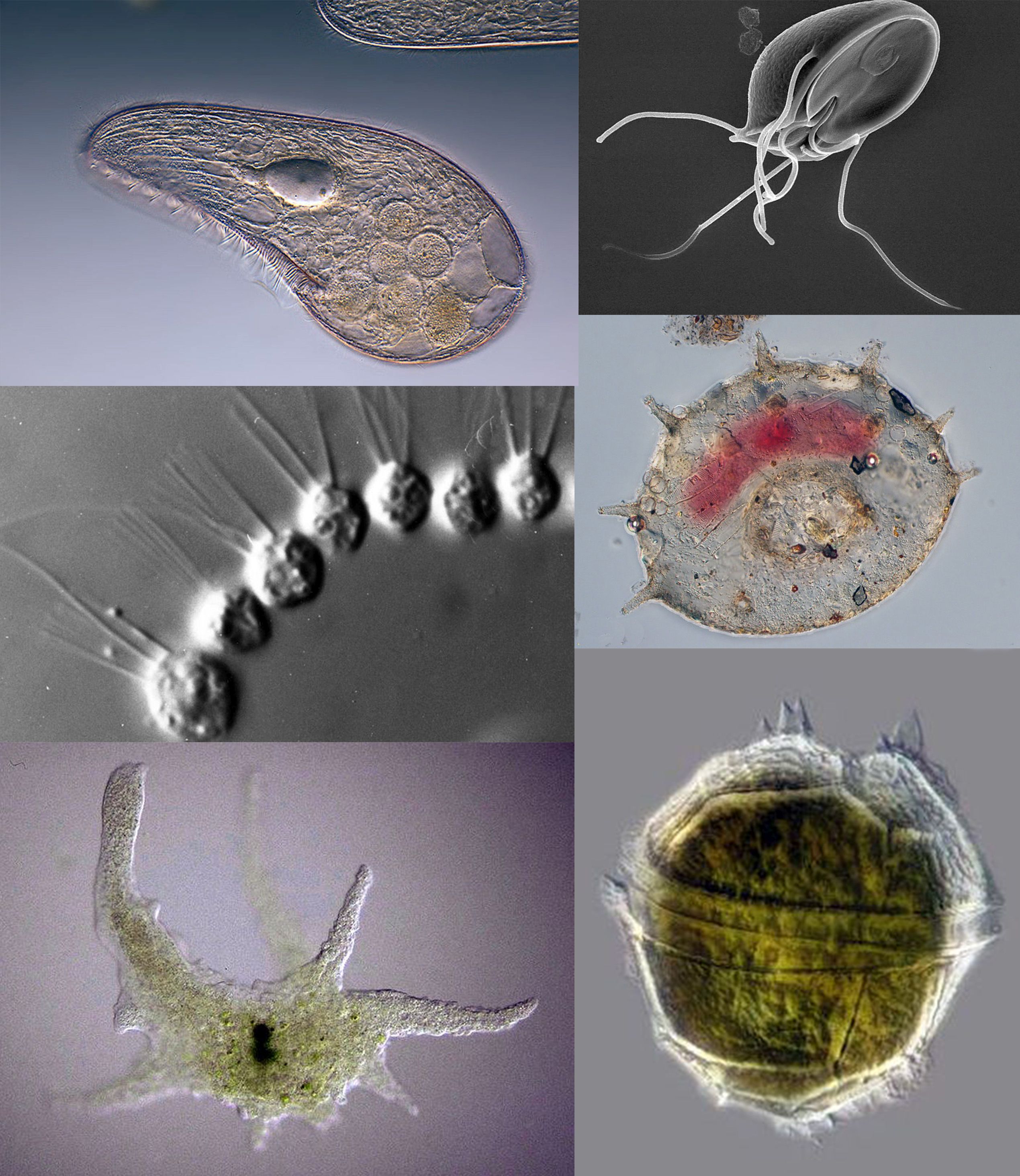 Protozoan parasites